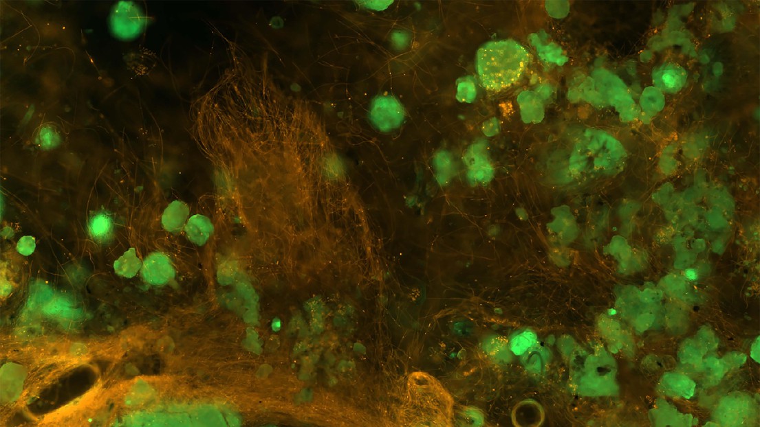 A microscope image of a complex biofilm.  © 2016 EPFL