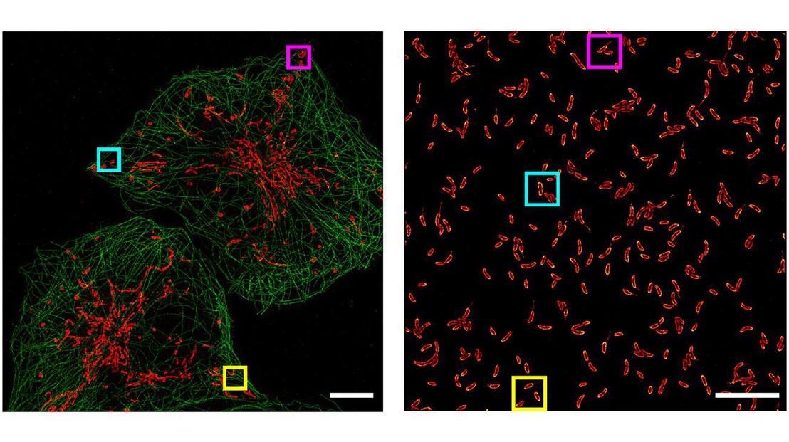 Dual-colour STORM images of COS-7 cells (left) and C. crescentus (R) taken with the new technique © Nature Photonics