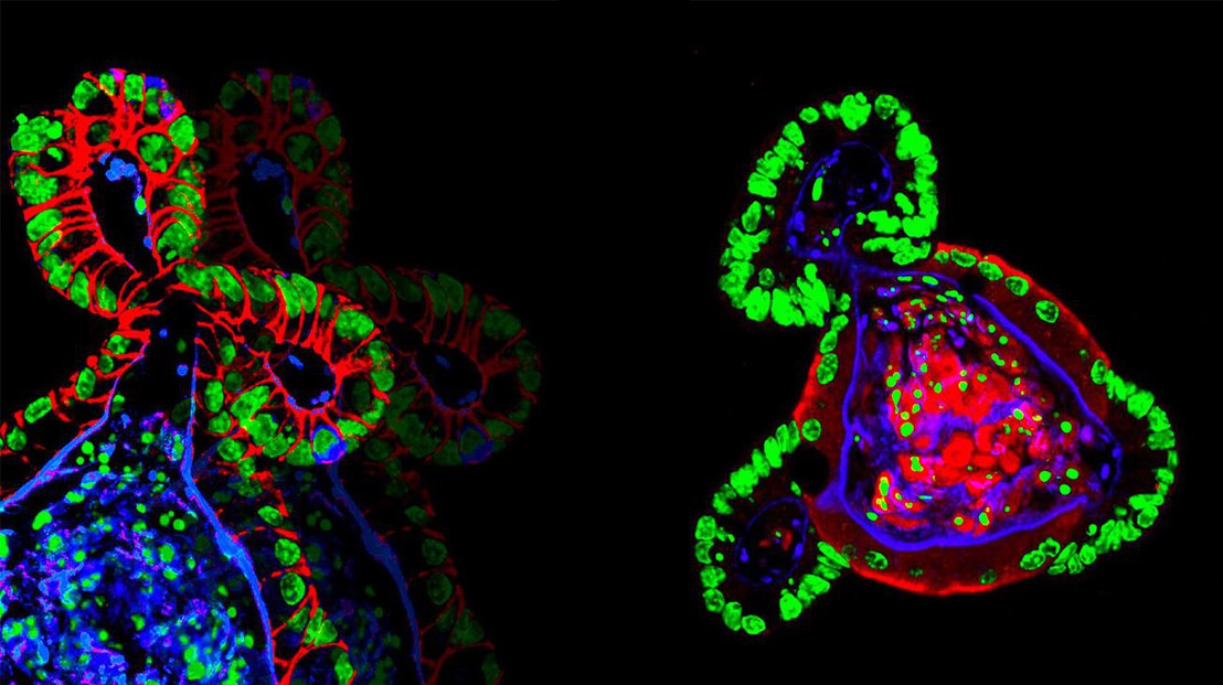 Intestinal organoids grown in synthetic hydrogels © N. Gjorevski/EPFL