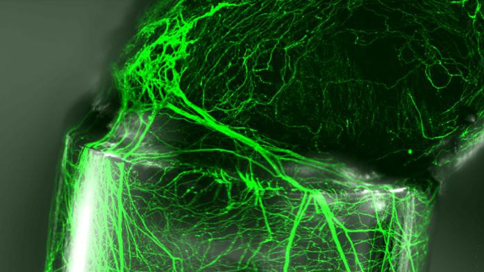Les scientifiques ont utilisé leurs fibres pour guider in vitro de manière ordonnée des neurites issues d’un ganglion spinal (ganglion situé sur le nerf rachidien). © 2017 EPFL