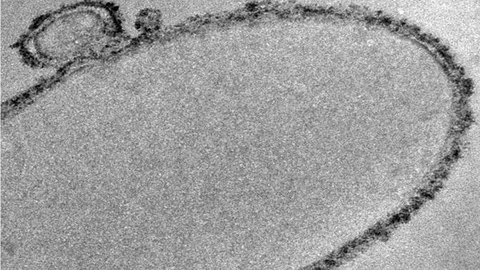 Micrographic image of a bacterium that has reduced uranium. © Paul Shao – EPFL 2017