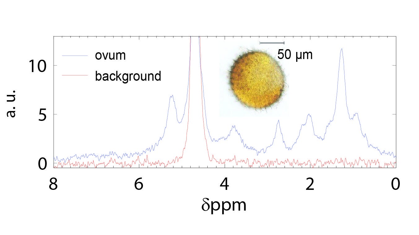 First NMR spectroscopy study on intact individual subnL ova EPFL