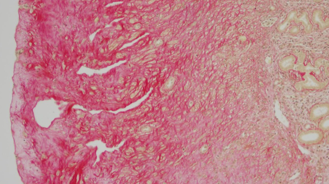 Accumulation of extracellular material in mice uterus. © EPFL
