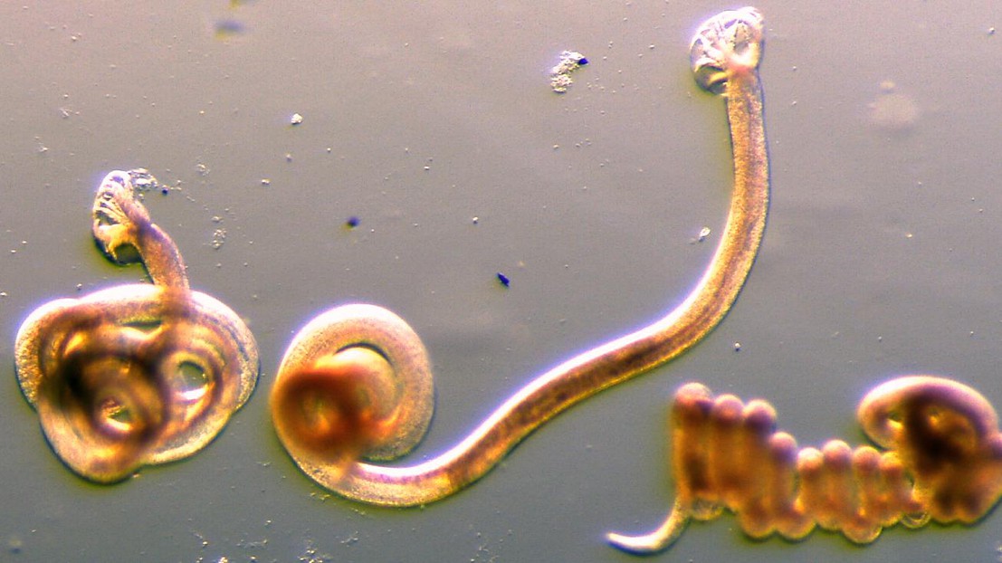 Le nématode Heligmosomoides Polygyrus, utilisé comme modèle parasite gastro-intestinal pour comprendre le mécanisme derrière la lymphangiogenèse des ganglions lymphatiques © Lalit Kumar Dubey / EPFL