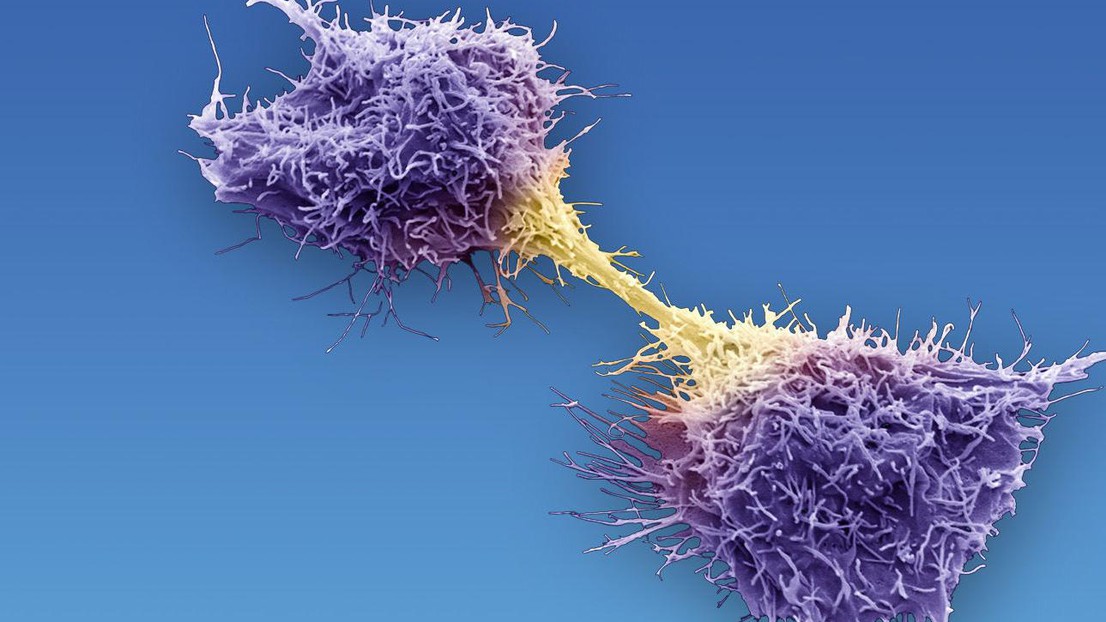 Cancer Cells  © 2017 Cellestia Biotech
