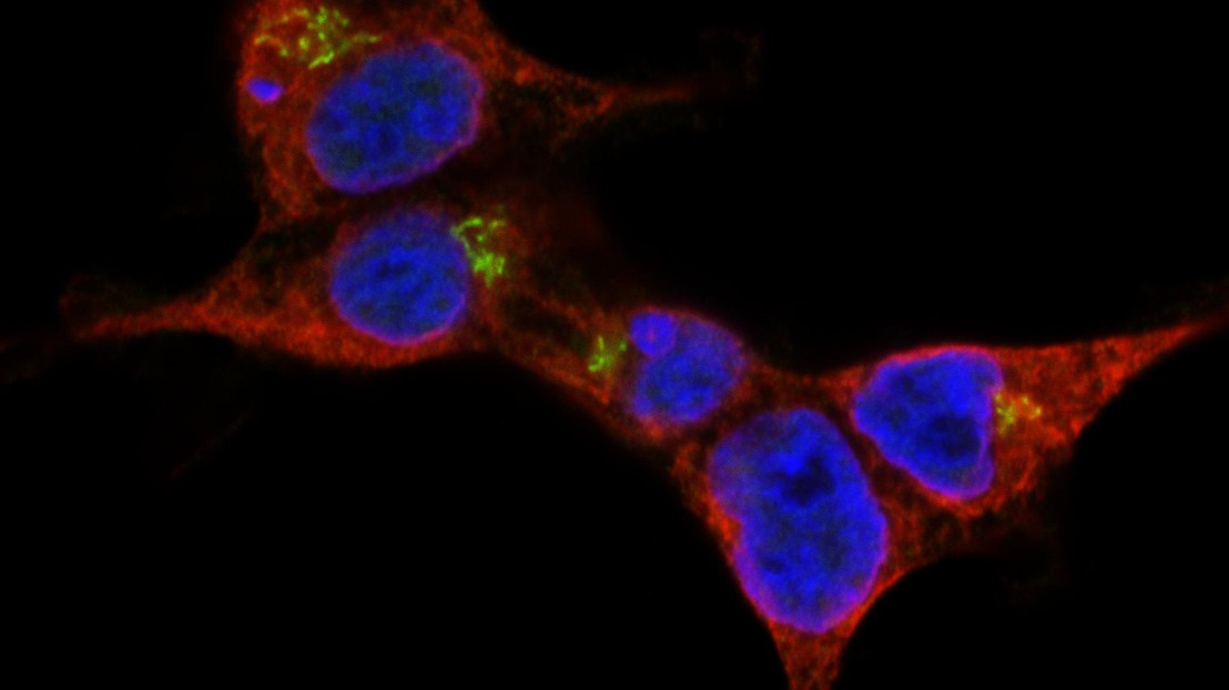 STING (vert), une protéine située sur le réticulum endoplasmique (rouge), réorganise l'activation et déclenche une réponse de mort spécifique au type cellulaire. Crédit: Simone Haag/A. Ablasser/EPFL