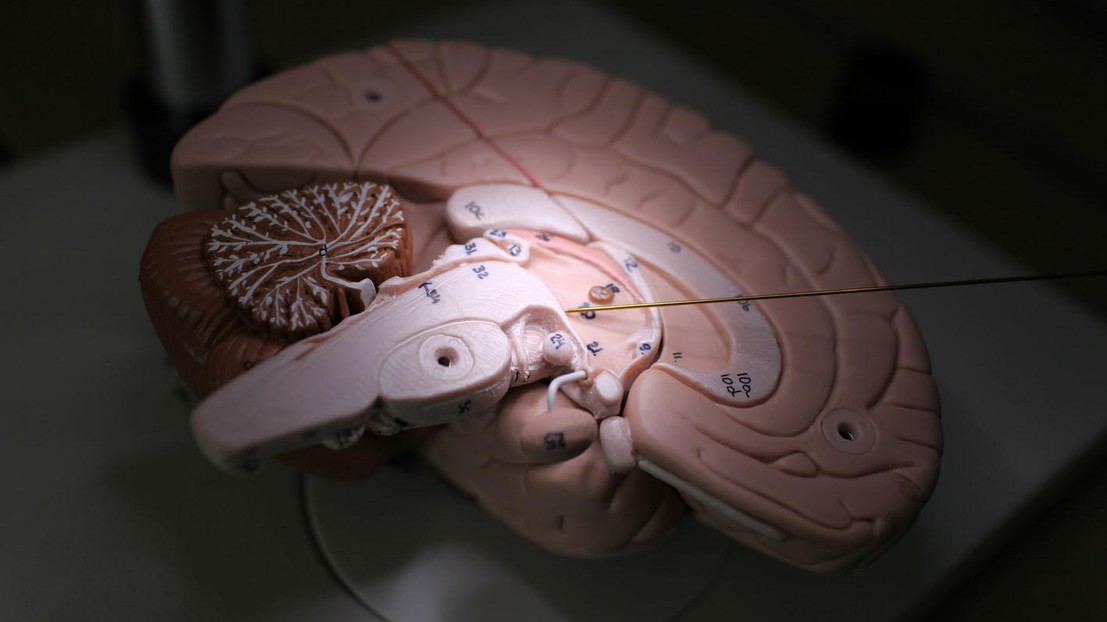 Aleva Neurotherapeutics develops deep brain stimulation systems© 2017 Alain Herzog