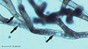 © 2017 parasite spores inside bryozoan