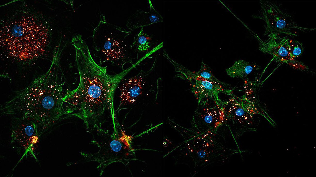 Two images of EVIR-engineered dendritic cells (green) capturing tumor antigens in exosomes (gold/red). Cell nuclei are colored blue. Credit: C. Cianciaruso/M. De Palma/EPFL
