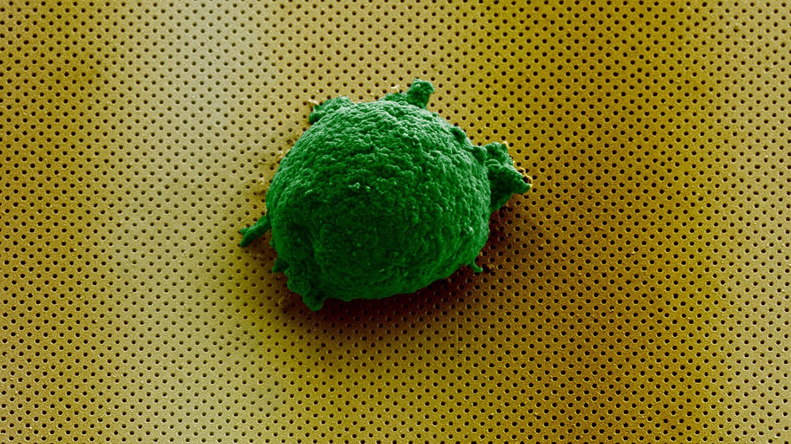 Microscopic image of a single cell artificially colored, laying on billions of nanoholes© Cover image of the forthcoming edition of Small / 2018 EPFL