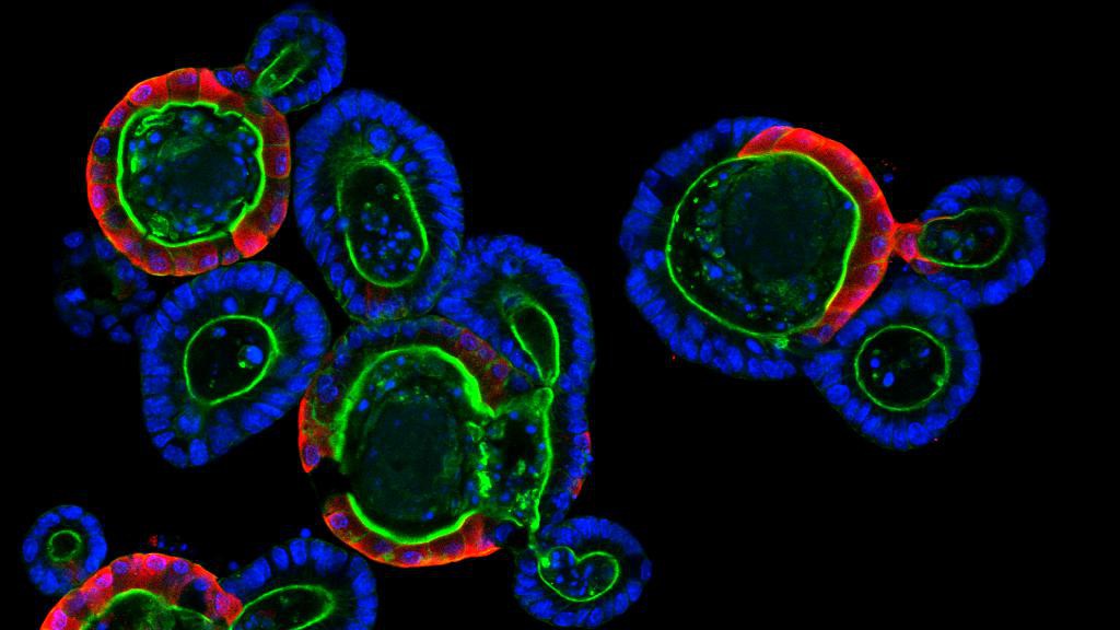 © Saba Rezakhani, Lütolf lab/EPFL