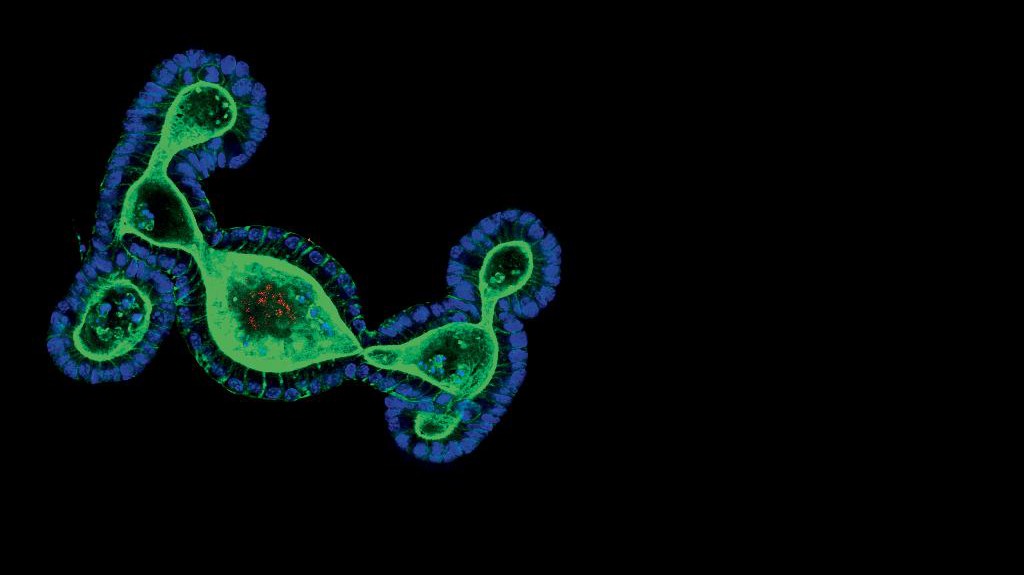 © Saba Rezakhani, Lütolf lab/EPFL