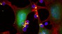 Les Cytokines (jaune) sont livrées aux cellules T (bleu) aux abords de la tumeur ©S K Kumari/Y Zheng