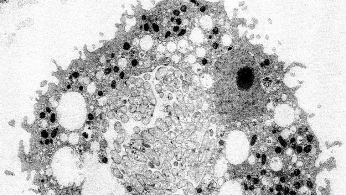 Electron micrograph of the cholera-causing pathogen inside an aquatic amoeba. Credit: Blokesch lab and BioEM facility