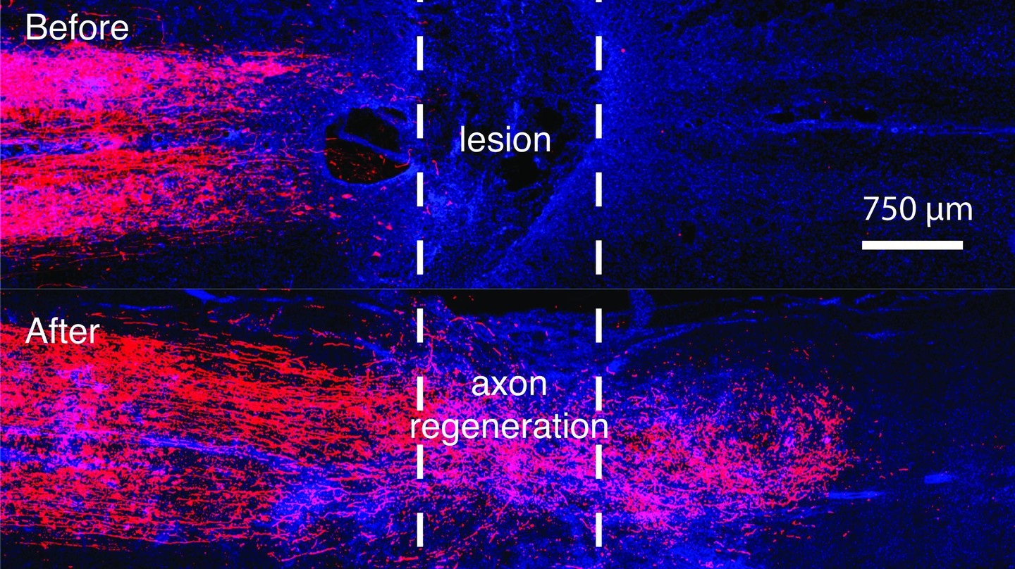 regenerating-nerve-fibers-across-spinal-cord-injury-epfl