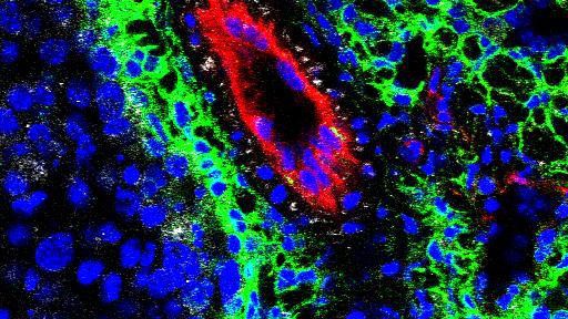 Des cellules lymphatiques (en rouge) assaillies par des lymphocytes (en vert) © 2012 EPFL