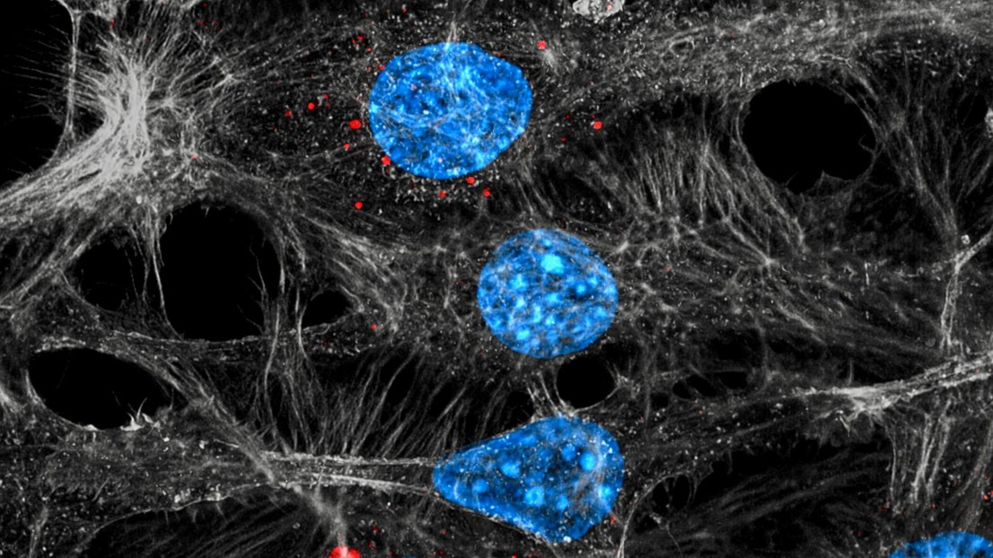 Des cellules endothéliales (en bleu/gris) internalisant des exosomes (en rouge) sécrétés par des tumeurs traitées par chimiothérapie (crédit: C. Cianciaruso/I. Keklikoglou)