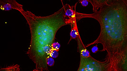 Cytokine is only delivered to the T-cells (in blue) when a tumor is around©S K Kumari/Y Zheng