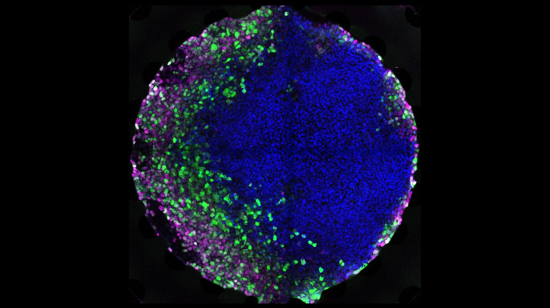 Des cellules souches embryonnaires humaines exposées à un gradient microfluidique d'un morphogène, entraînant l'établissement de différents types de cellules. Crédit: Andrea Manfrin (EPFL)