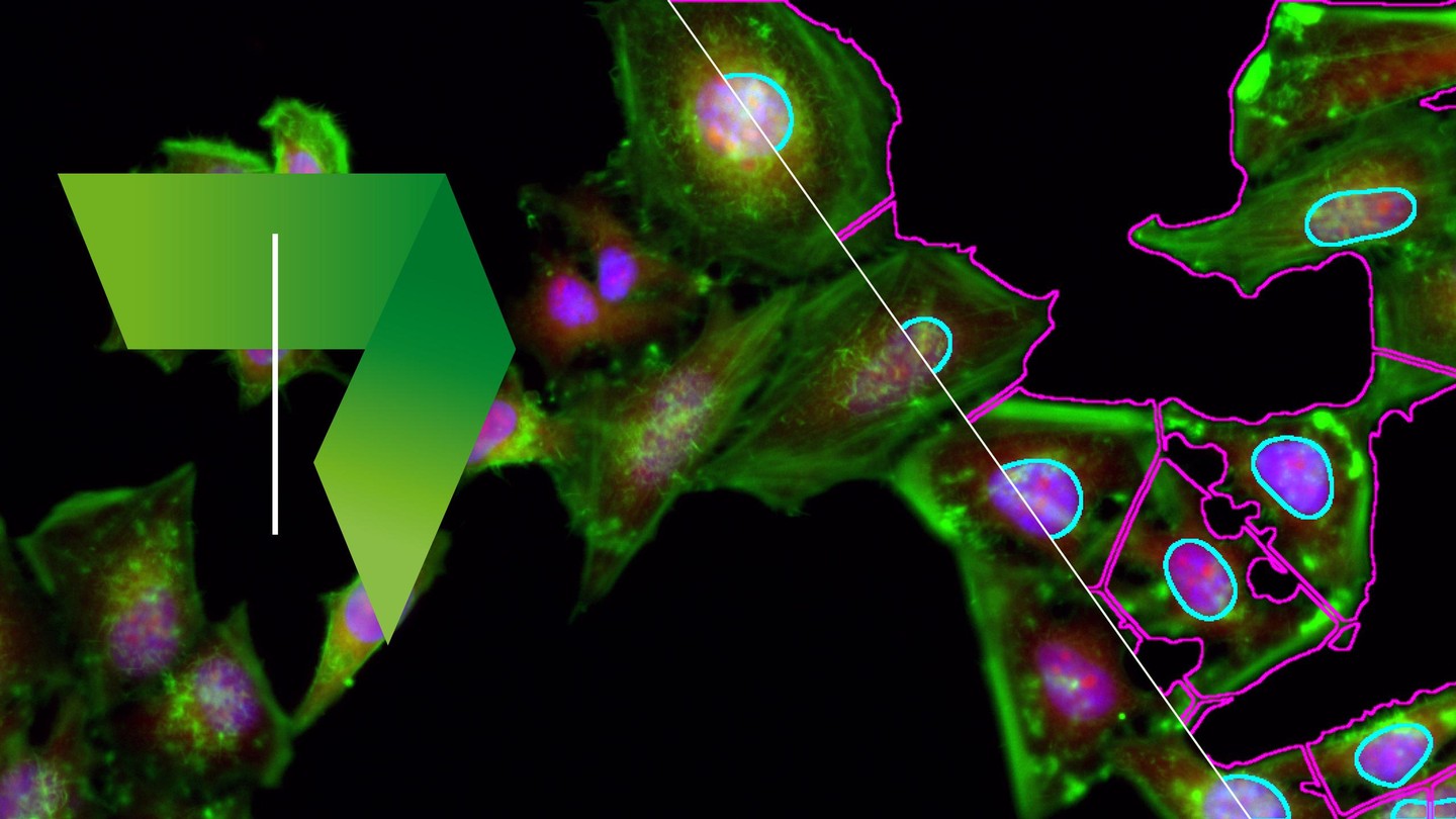 MOOC: Image Processing and Analysis for Life Scientists - EPFL