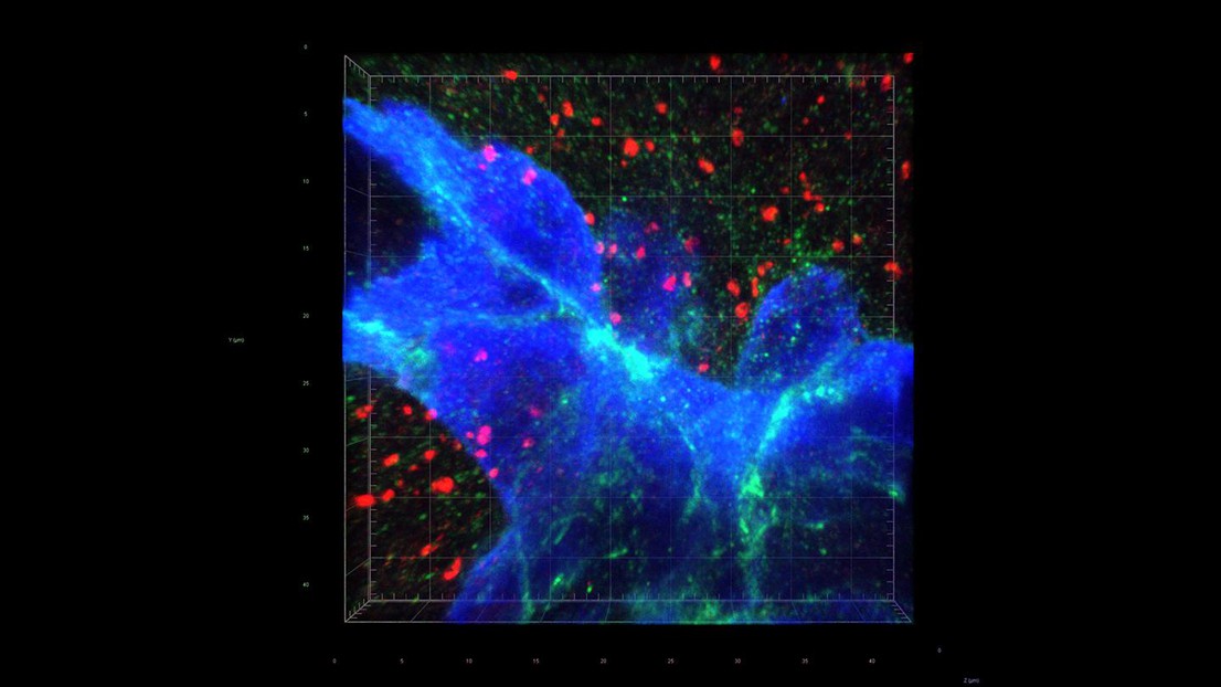 La proximité synaptique ouvre la voie aux métastases cérébrales. Crédit: W. Jiao et Q. Zeng (EPFL)
