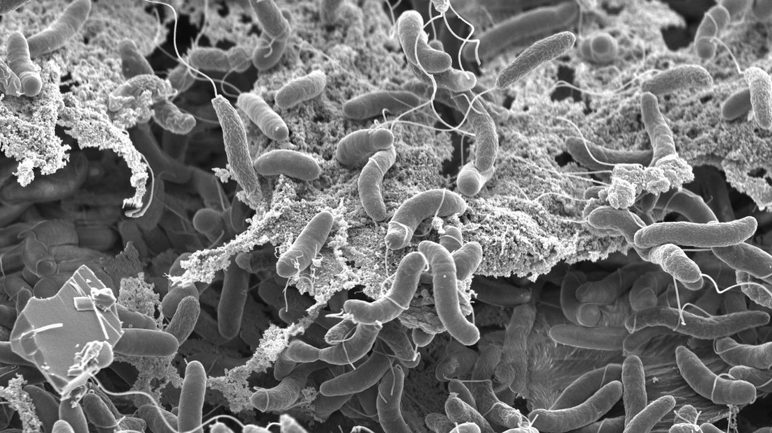 Vibrio cholerae bacteria form dense biofilms on biotic surfaces, which fosters interbacterial killing and horizontal gene transfer. Credit: G. Knott & M. Blokesch, EPFL