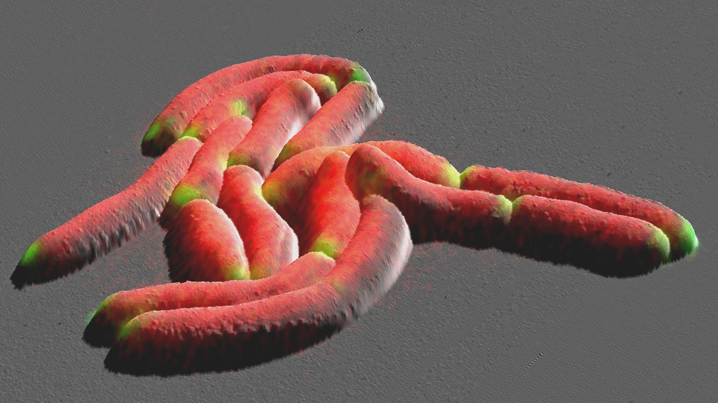 Bacteria under the microscope: a new growth model for tuberculosis - EPFL