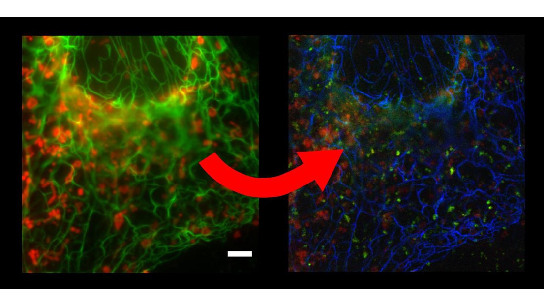 From two channel to three color SOFI imaging. Blue: Vimentin cytoskeleton filaments, red: mitochondria, green: wheat-germ agglutinin. Scale bar: 5 microns. © K. Grussmayer / EPFL 2020