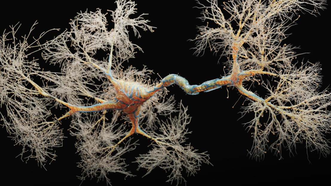 A neuron. Credit: iStock photos