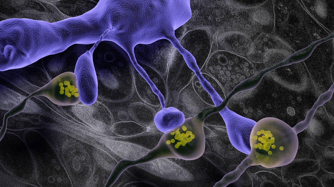 3D model of dendritic spines (purple) making synapses with axons containing vesicles (yellow). Background shows electron microscope image of brain tissue. Credit: Graham Knott (EPFL)