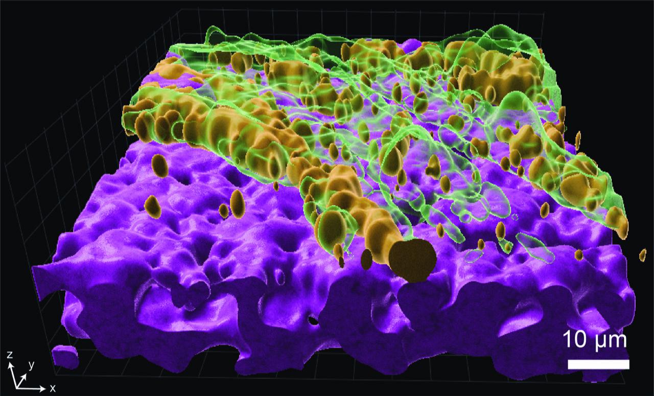 Pseudomonas aeruginosa cells (orange) growing on the mucus layer (green) of the airway mucosa. Airway epithelial cells are shown in purple. Credit: Lucas Meirelles (EPFL).