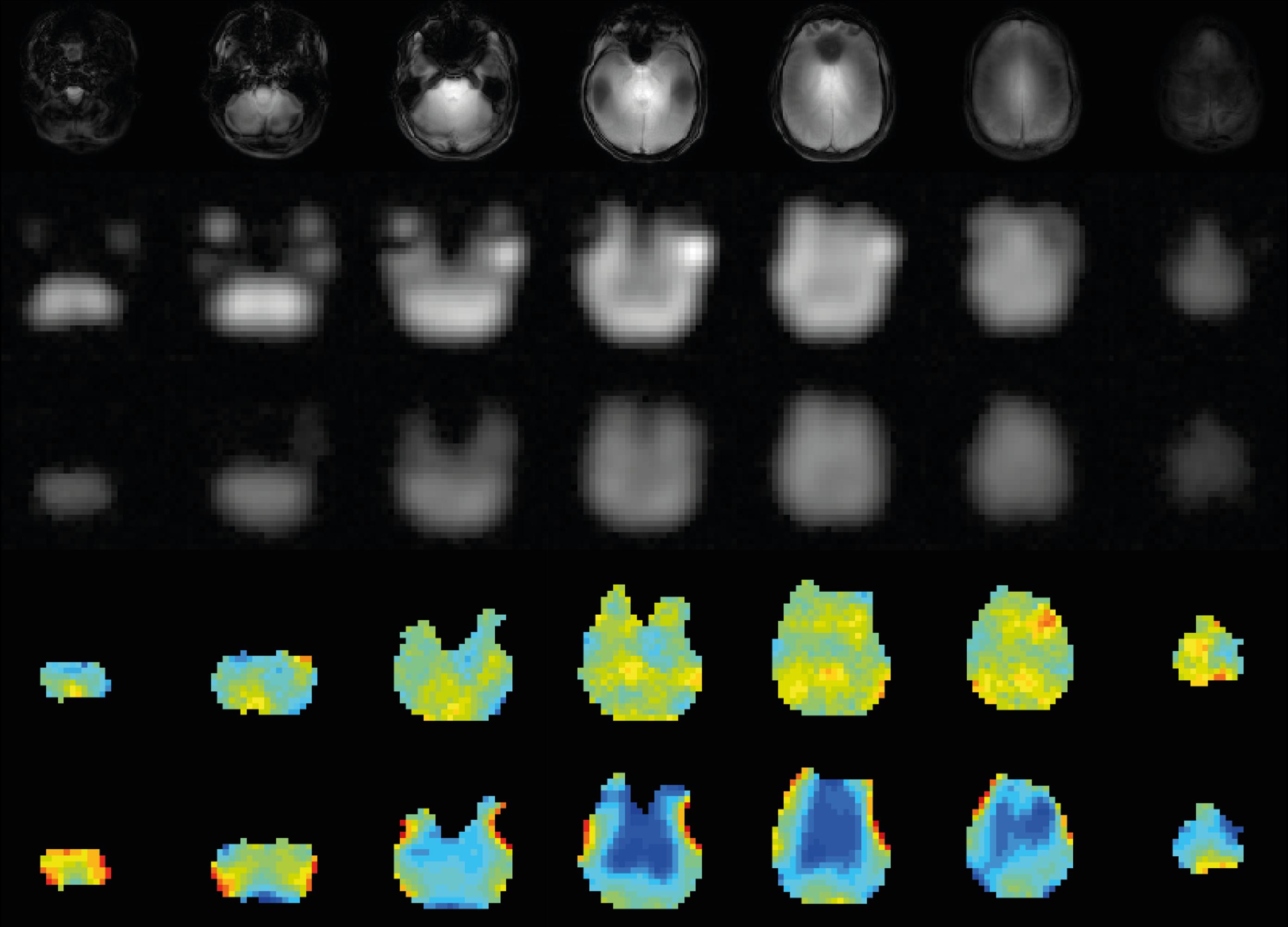 Brain scans using CKI. Credit: Lijin Xin (EPFL)