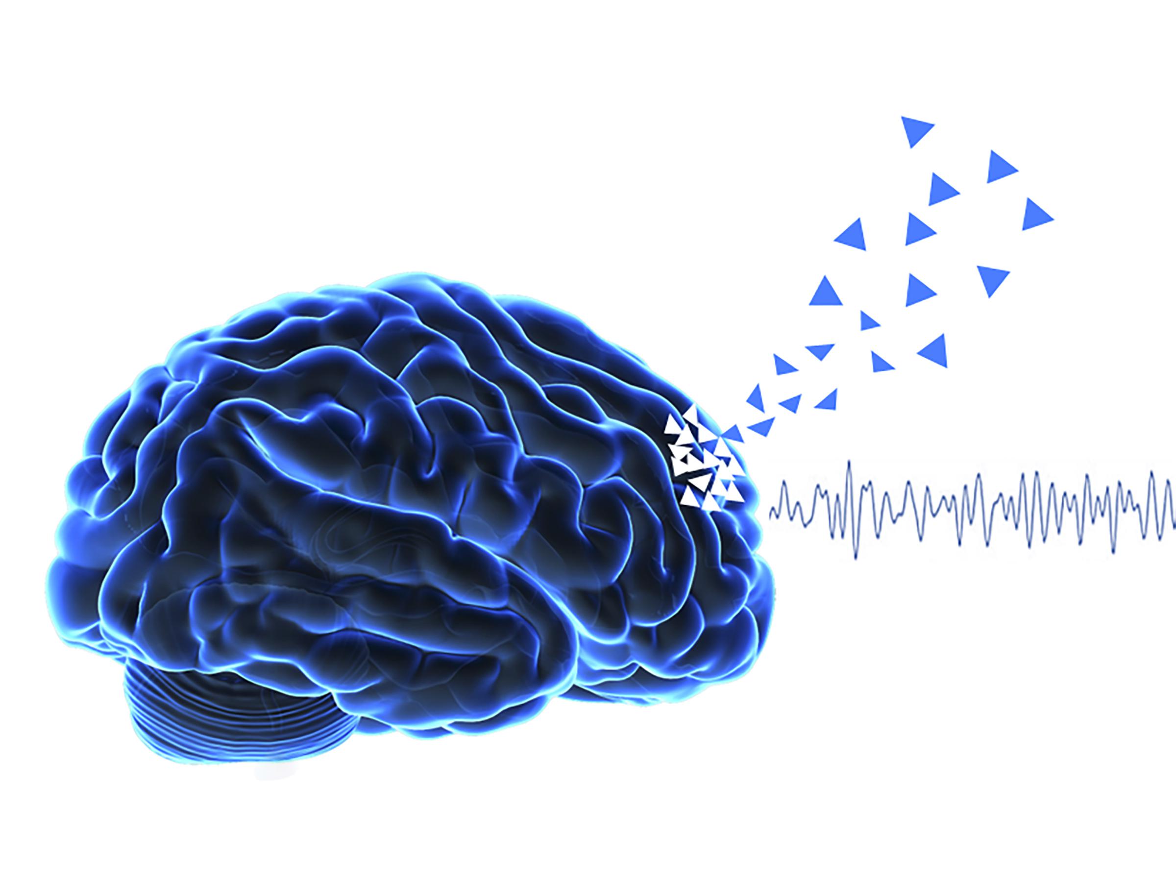 Early hallucinations in Parkinson's disease are associated with a rapid frontal cognitive decline (illustrated by the triangles), and is anticipated by a specific frontal neural oscillation (Theta frequency band).