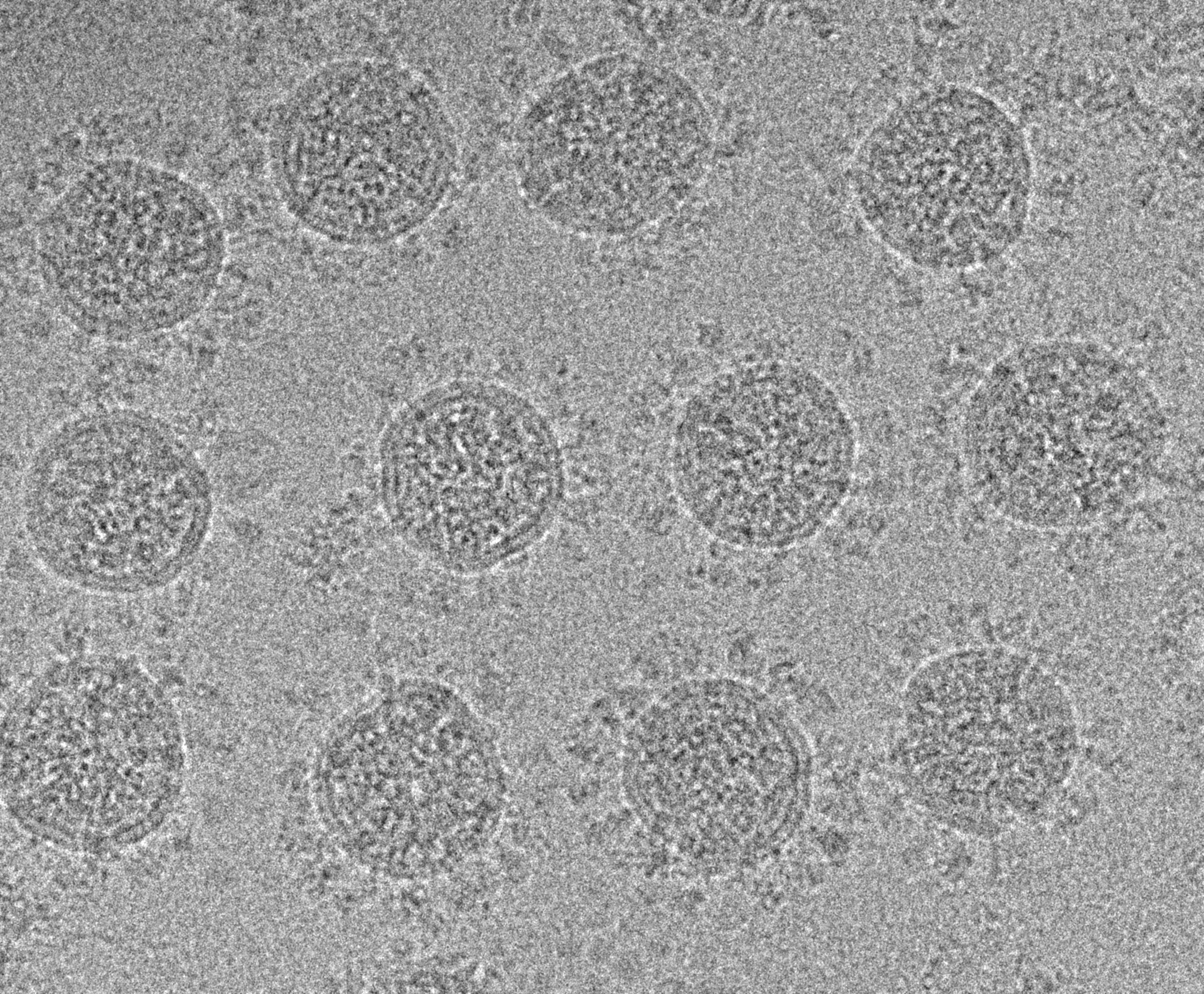 Cryoelectronic microscopy image of concentrated, PFA-fixed SARS-CoV-2 virion suspensions. Credit: van der Goot lab and D. Demurtas (BioEM EPFL Core Facility).