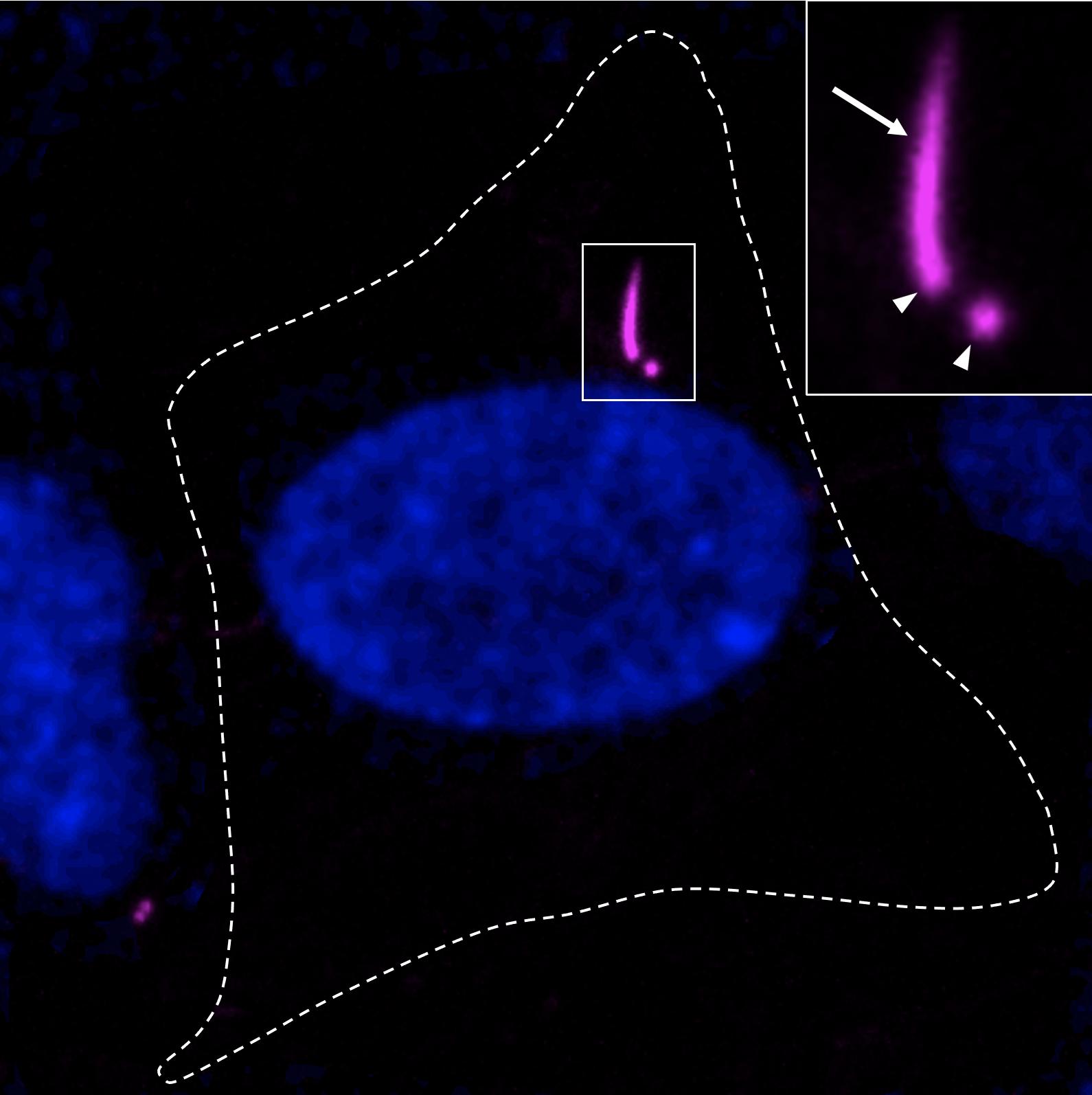 Imagerie par disque rotatif de cellules vivantes de l'épithélium pigmentaire rétinien (EPR) humain de type -1 marquées au CenSpark-650 (magenta). L'ADN est représenté en bleu et les limites cellulaires sont indiquées par une ligne pointillée. Le détail (en magenta uniquement) met en évidence les centrioles (flèches) et le cil primaire (flèche). Crédit : Pierre Gönczy © 2026 EPFL