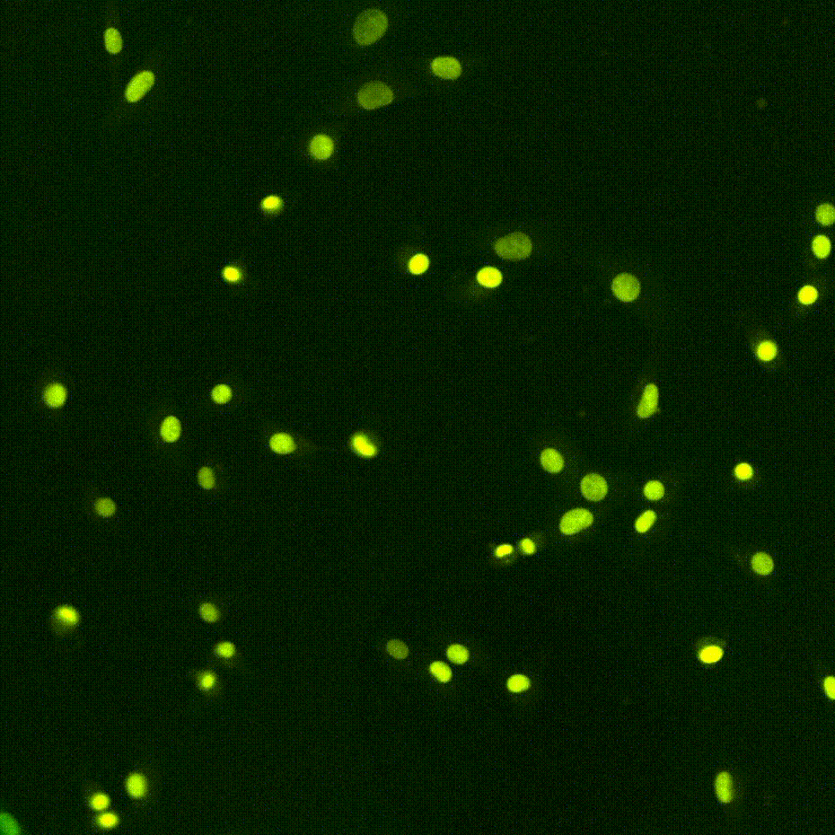 Fibroblastes cultivés exprimant un marqueur fluorescent dans le noyau; le changement progressif de couleur indique une diminution du renouvellement protéique. Crédit: 2025 EPFL/Benjamin Martin CC-BY-SA 4.0